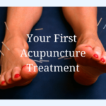 What to wear to an acupuncture appointment